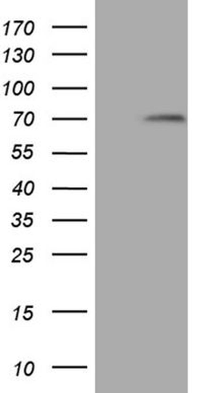 MAK Antibody in Western Blot (WB)