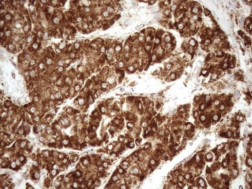 SHMT2 Antibody in Immunohistochemistry (Paraffin) (IHC (P))