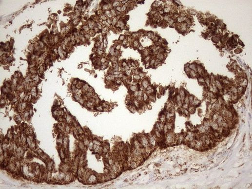 SHMT2 Antibody in Immunohistochemistry (Paraffin) (IHC (P))