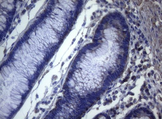 MAK Antibody in Immunohistochemistry (Paraffin) (IHC (P))