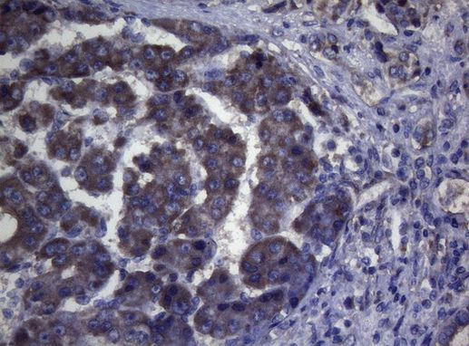 MAK Antibody in Immunohistochemistry (Paraffin) (IHC (P))