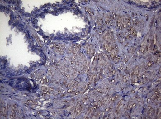 MAK Antibody in Immunohistochemistry (Paraffin) (IHC (P))