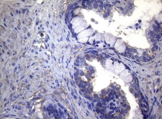 MAK Antibody in Immunohistochemistry (Paraffin) (IHC (P))