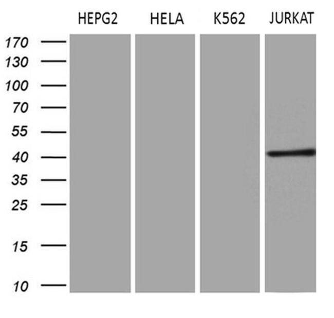 ERLIN1 Antibody in Western Blot (WB)