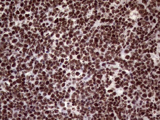 XRN2 Antibody in Immunohistochemistry (Paraffin) (IHC (P))