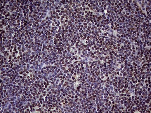 XRN2 Antibody in Immunohistochemistry (Paraffin) (IHC (P))