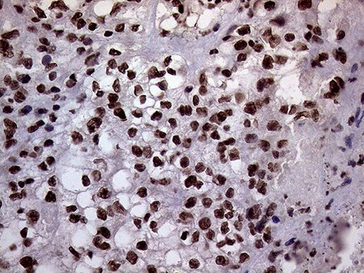 XRN2 Antibody in Immunohistochemistry (Paraffin) (IHC (P))