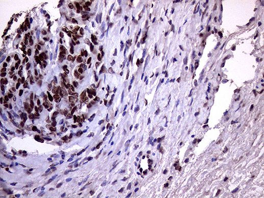 XRN2 Antibody in Immunohistochemistry (Paraffin) (IHC (P))