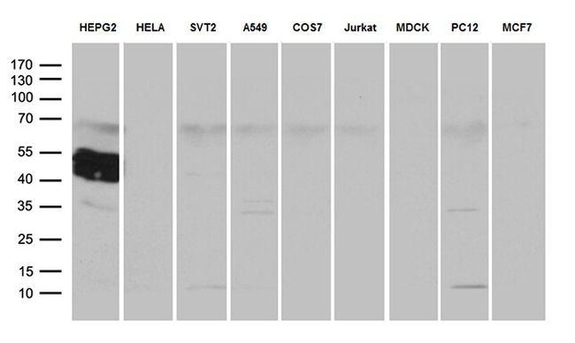 ZCCHC17 Antibody in Western Blot (WB)