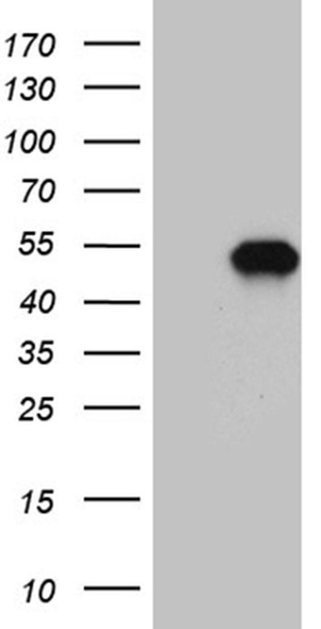MEIS1 Antibody in Western Blot (WB)