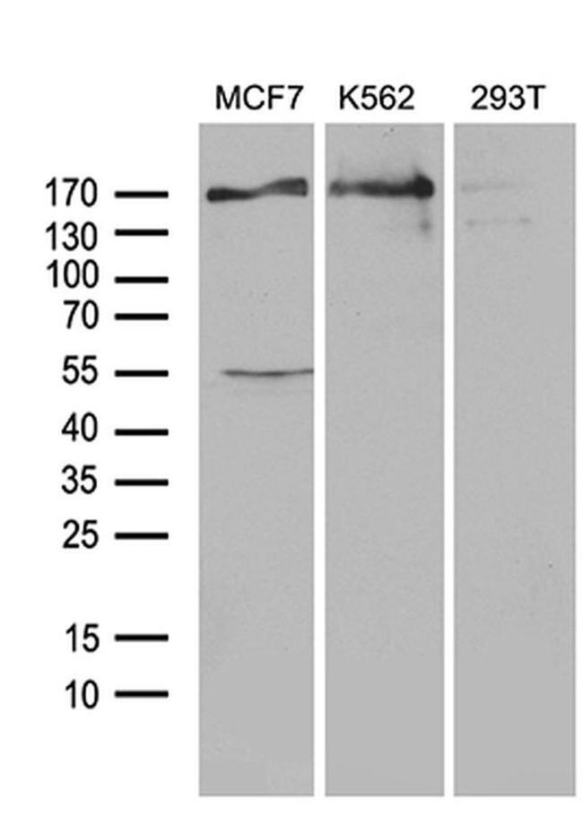 USP40 Antibody in Western Blot (WB)