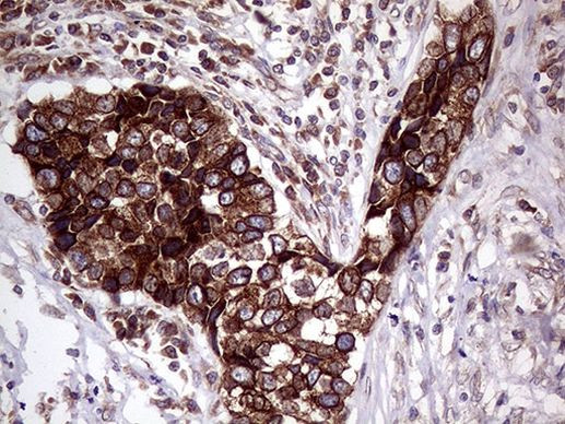 Lass2 Antibody in Immunohistochemistry (Paraffin) (IHC (P))