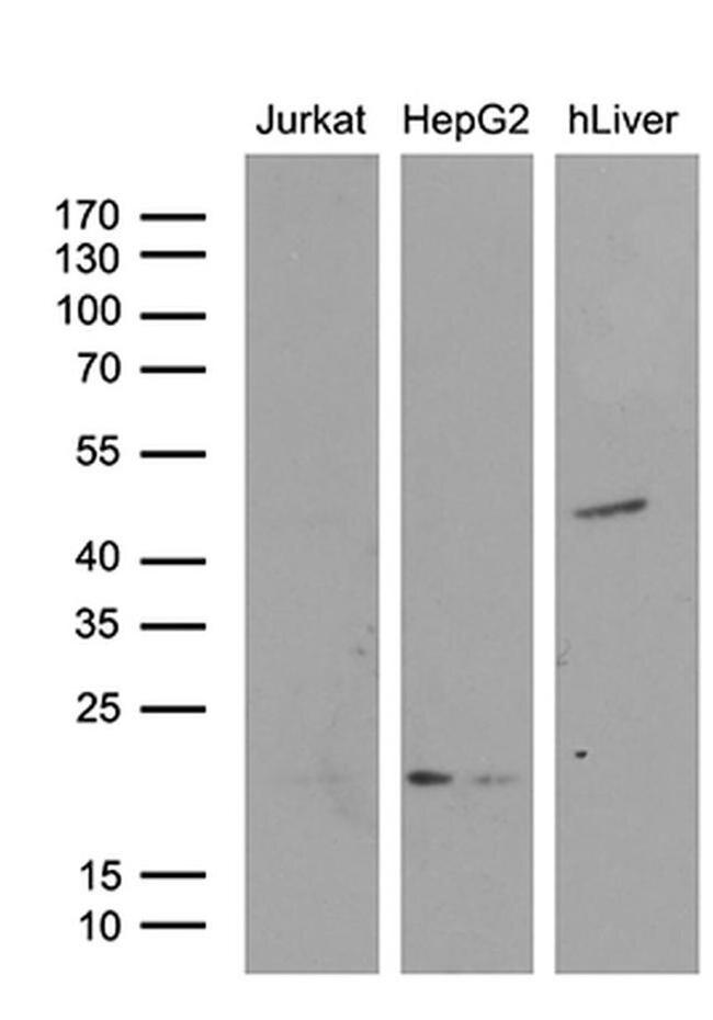 AMDHD1 Antibody in Western Blot (WB)