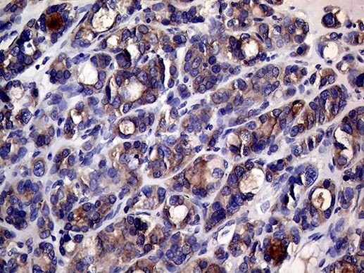 CHP1 Antibody in Immunohistochemistry (Paraffin) (IHC (P))