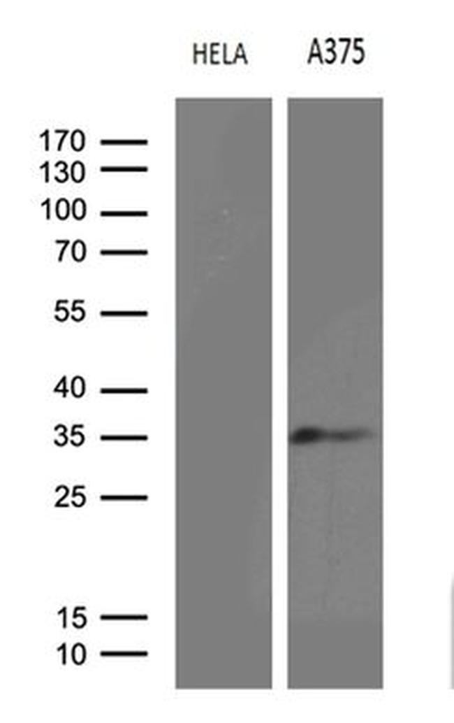 RPAIN Antibody in Western Blot (WB)