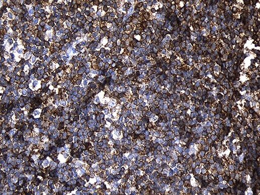 PLAC8 Antibody in Immunohistochemistry (Paraffin) (IHC (P))