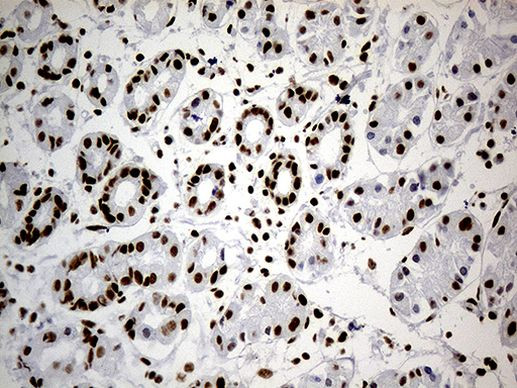 hnRNP H1 Antibody in Immunohistochemistry (Paraffin) (IHC (P))