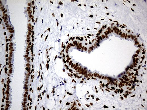 hnRNP H1 Antibody in Immunohistochemistry (Paraffin) (IHC (P))