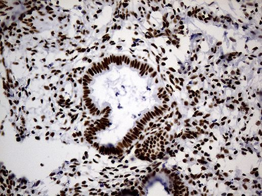 hnRNP H1 Antibody in Immunohistochemistry (Paraffin) (IHC (P))