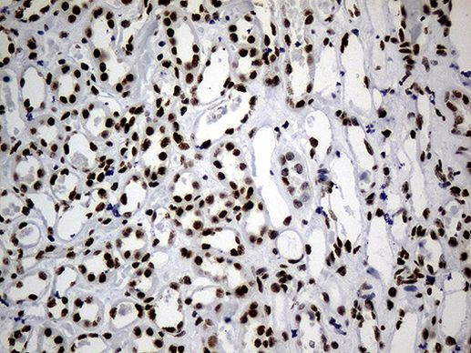 hnRNP H1 Antibody in Immunohistochemistry (Paraffin) (IHC (P))