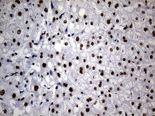 hnRNP H1 Antibody in Immunohistochemistry (Paraffin) (IHC (P))