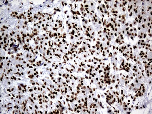 hnRNP H1 Antibody in Immunohistochemistry (Paraffin) (IHC (P))