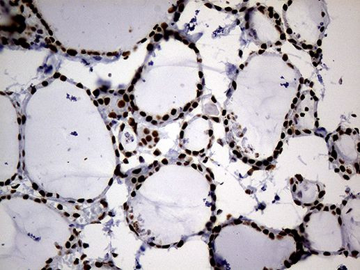 hnRNP H1 Antibody in Immunohistochemistry (Paraffin) (IHC (P))