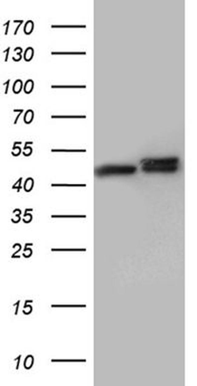 hnRNP H1 Antibody in Western Blot (WB)