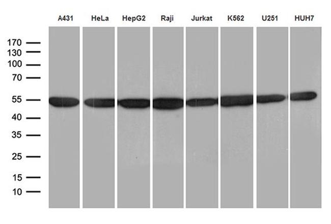 hnRNP H1 Antibody in Western Blot (WB)