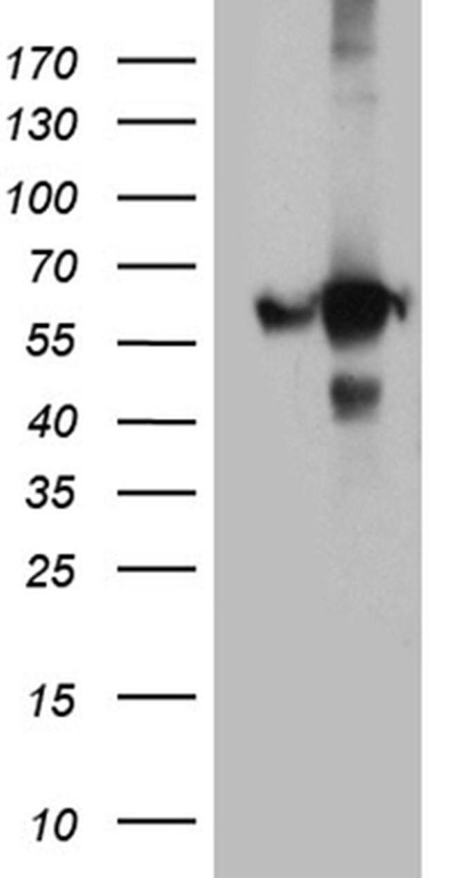 GDI1 Antibody in Western Blot (WB)