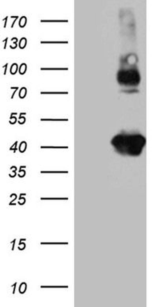 Syntaxin 3 Antibody in Western Blot (WB)