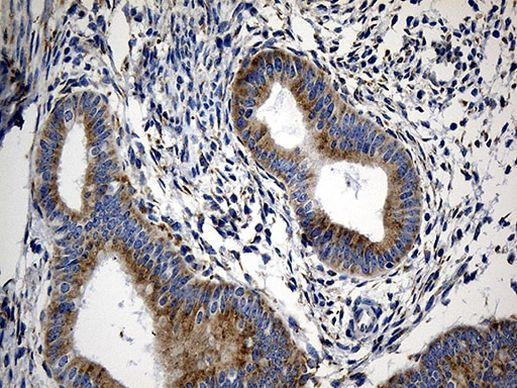 CCDC22 Antibody in Immunohistochemistry (Paraffin) (IHC (P))