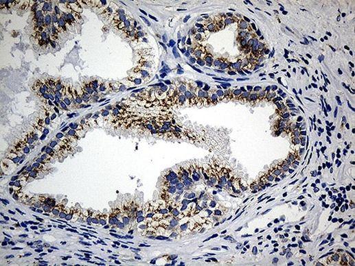 CCDC22 Antibody in Immunohistochemistry (Paraffin) (IHC (P))