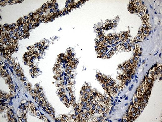 CCDC22 Antibody in Immunohistochemistry (Paraffin) (IHC (P))