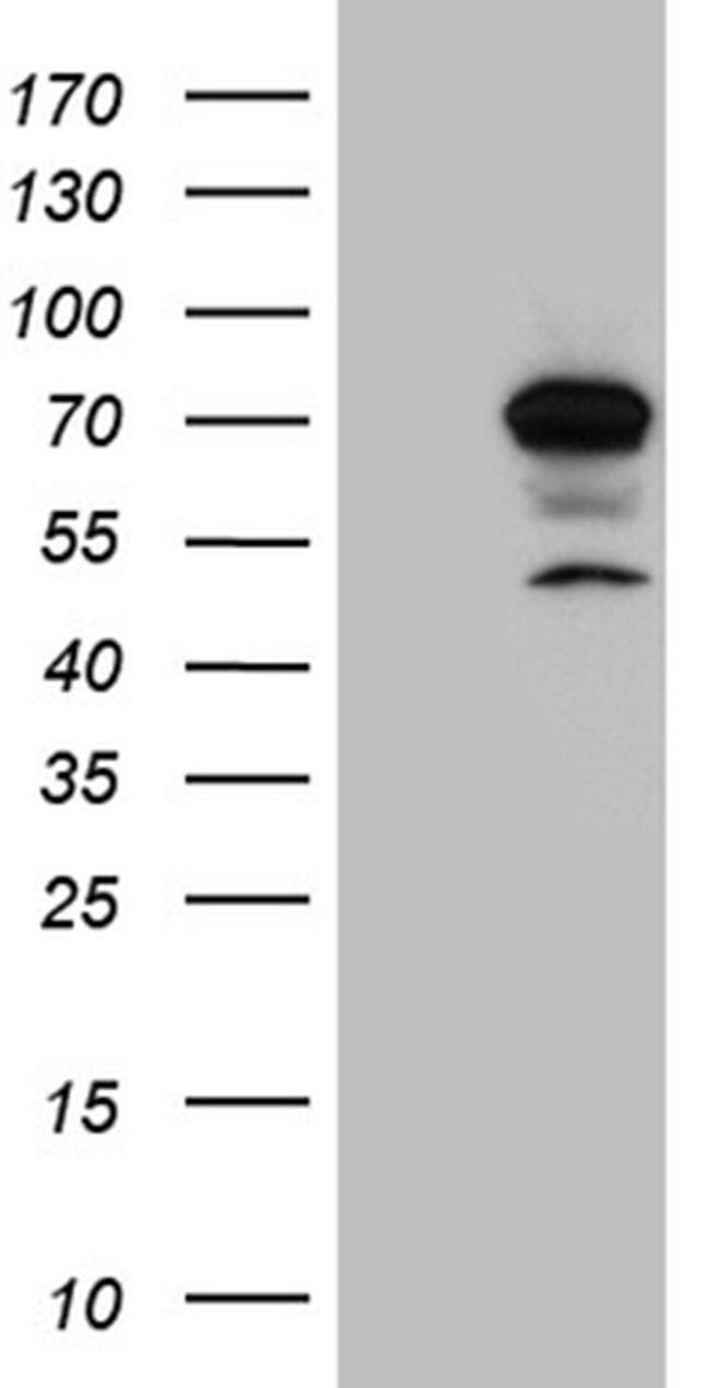 CCDC22 Antibody in Western Blot (WB)
