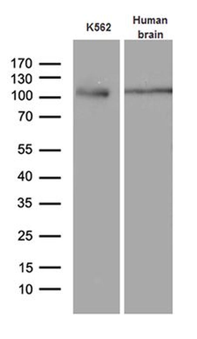 AGO1 Antibody in Western Blot (WB)