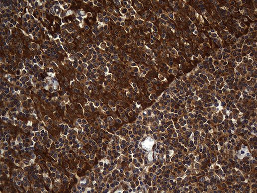 ALDH7A1 Antibody in Immunohistochemistry (Paraffin) (IHC (P))