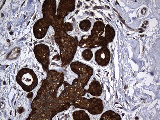 ALDH7A1 Antibody in Immunohistochemistry (Paraffin) (IHC (P))