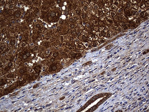 ALDH7A1 Antibody in Immunohistochemistry (Paraffin) (IHC (P))