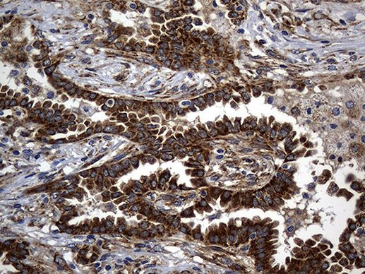 ALDH7A1 Antibody in Immunohistochemistry (Paraffin) (IHC (P))