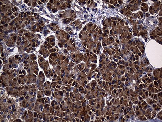 ALDH7A1 Antibody in Immunohistochemistry (Paraffin) (IHC (P))