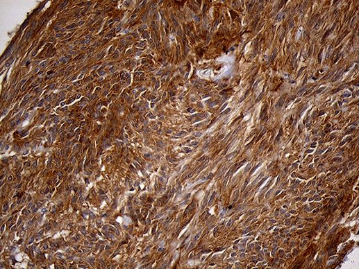 PYGM Antibody in Immunohistochemistry (Paraffin) (IHC (P))