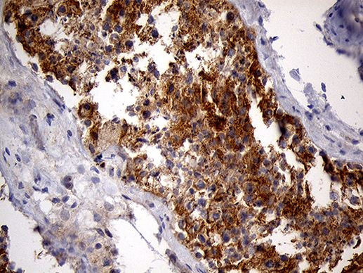 PYGM Antibody in Immunohistochemistry (Paraffin) (IHC (P))