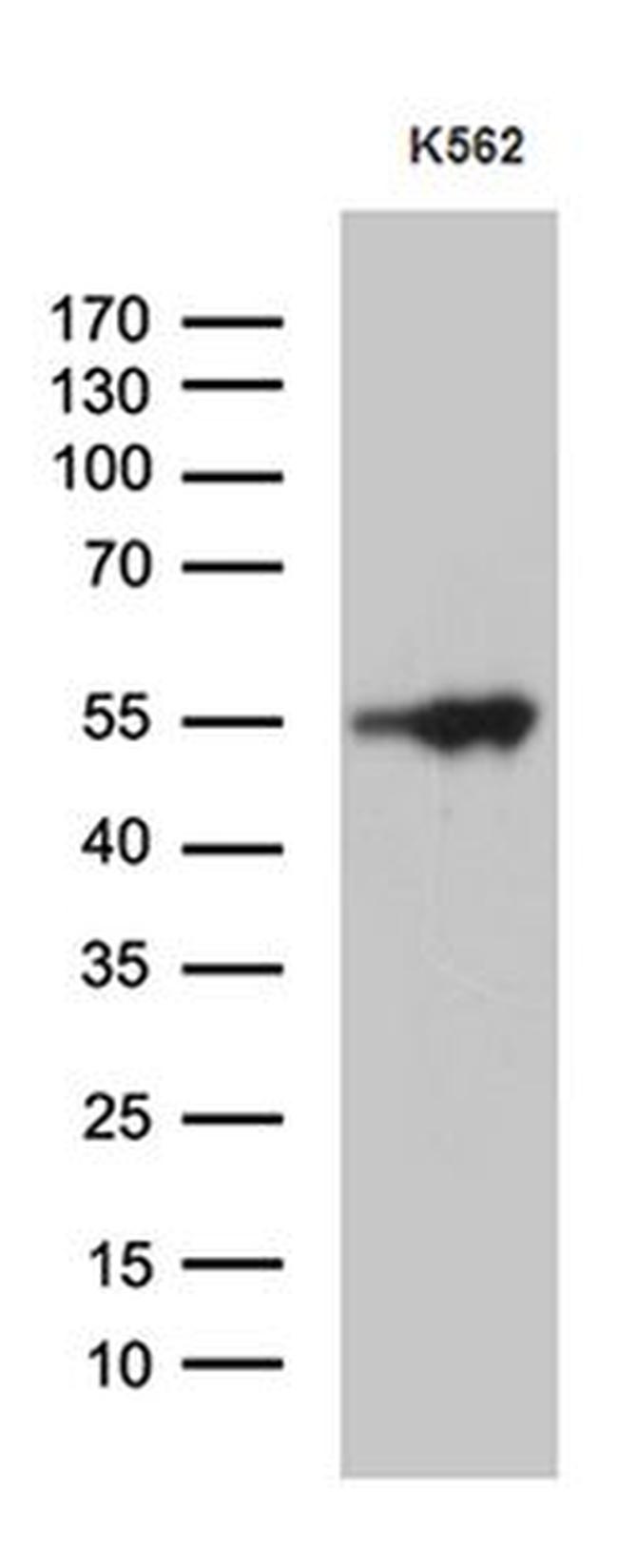 VRK2 Antibody in Western Blot (WB)