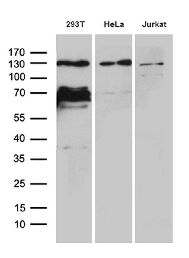 ZNF655 Antibody in Western Blot (WB)