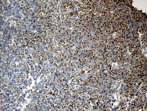 ACADM Antibody in Immunohistochemistry (Paraffin) (IHC (P))