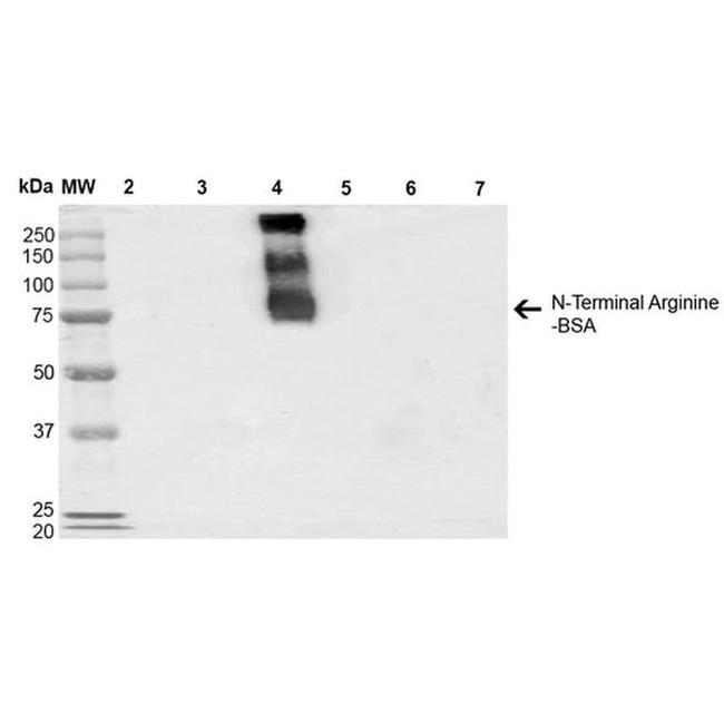 N-terminal Arginylation Antibody in Western Blot (WB)