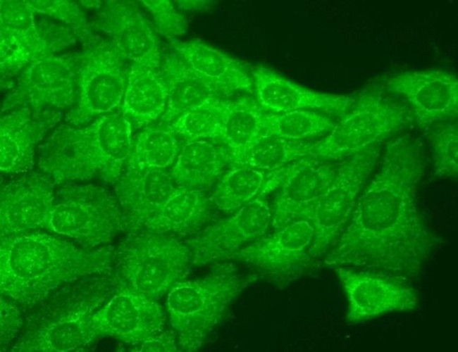 ATAD1 Antibody in Immunocytochemistry (ICC/IF)