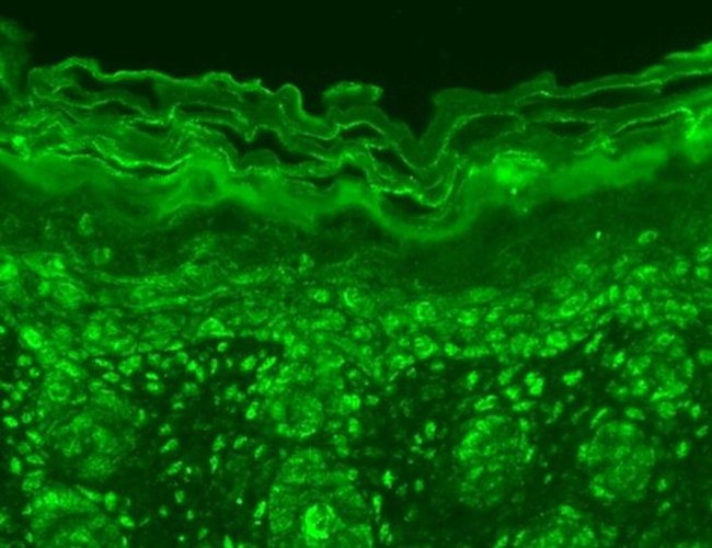 ATAD1 Antibody in Immunohistochemistry (Paraffin) (IHC (P))