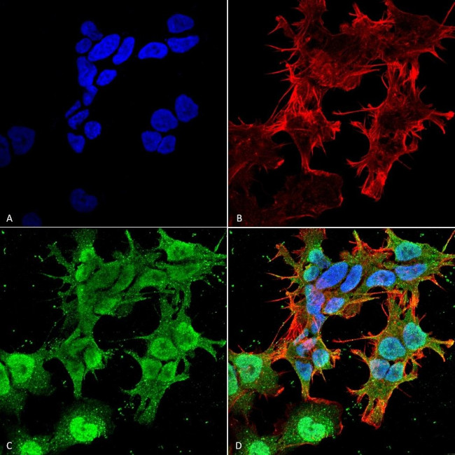 Stargazin Antibody in Immunocytochemistry (ICC/IF)